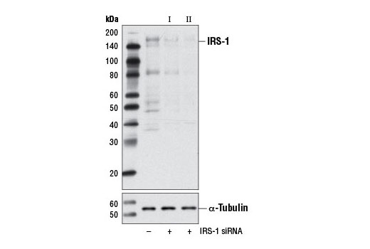  Image 1: SignalSilence® IRS-1 siRNA II (Mouse Specific)