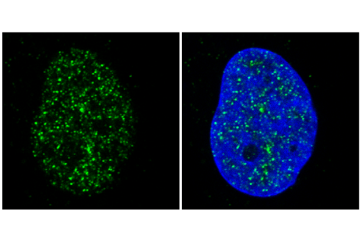 Immunofluorescence Image 1: BRD4 (E4X7E) Mouse mAb