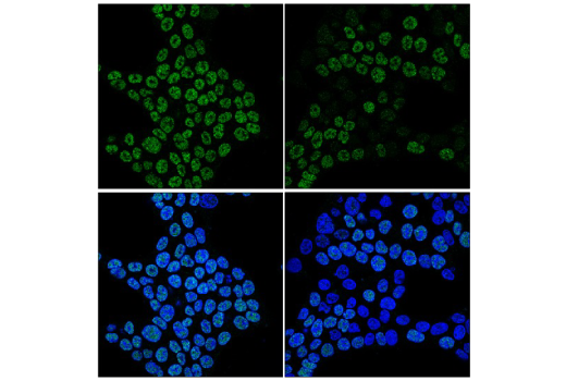 Immunofluorescence Image 3: BRD4 (E4X7E) Mouse mAb
