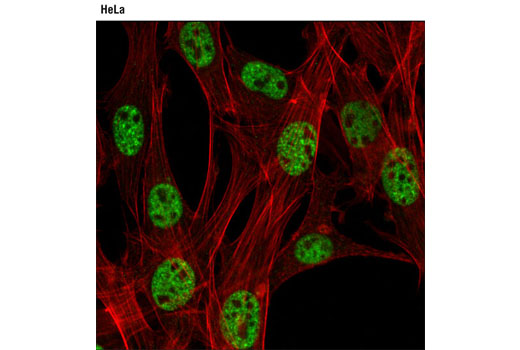 Immunofluorescence Image 1: CBP (D6C5) Rabbit mAb (BSA and Azide Free)