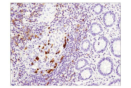 Immunohistochemistry Image 3: PD-1 (D4W2J) XP® Rabbit mAb (BSA and Azide Free)