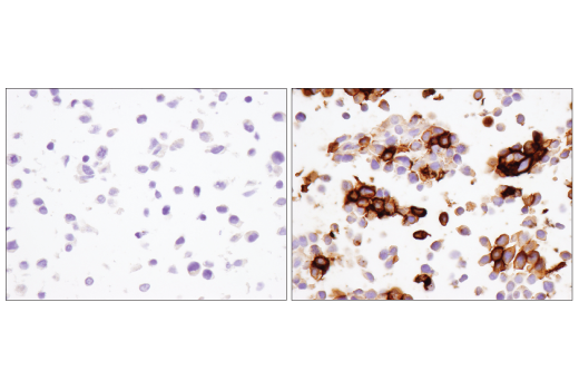Immunohistochemistry Image 6: PD-1 (Intracellular Domain) (D4W2J) XP® Rabbit mAb (BSA and Azide Free)