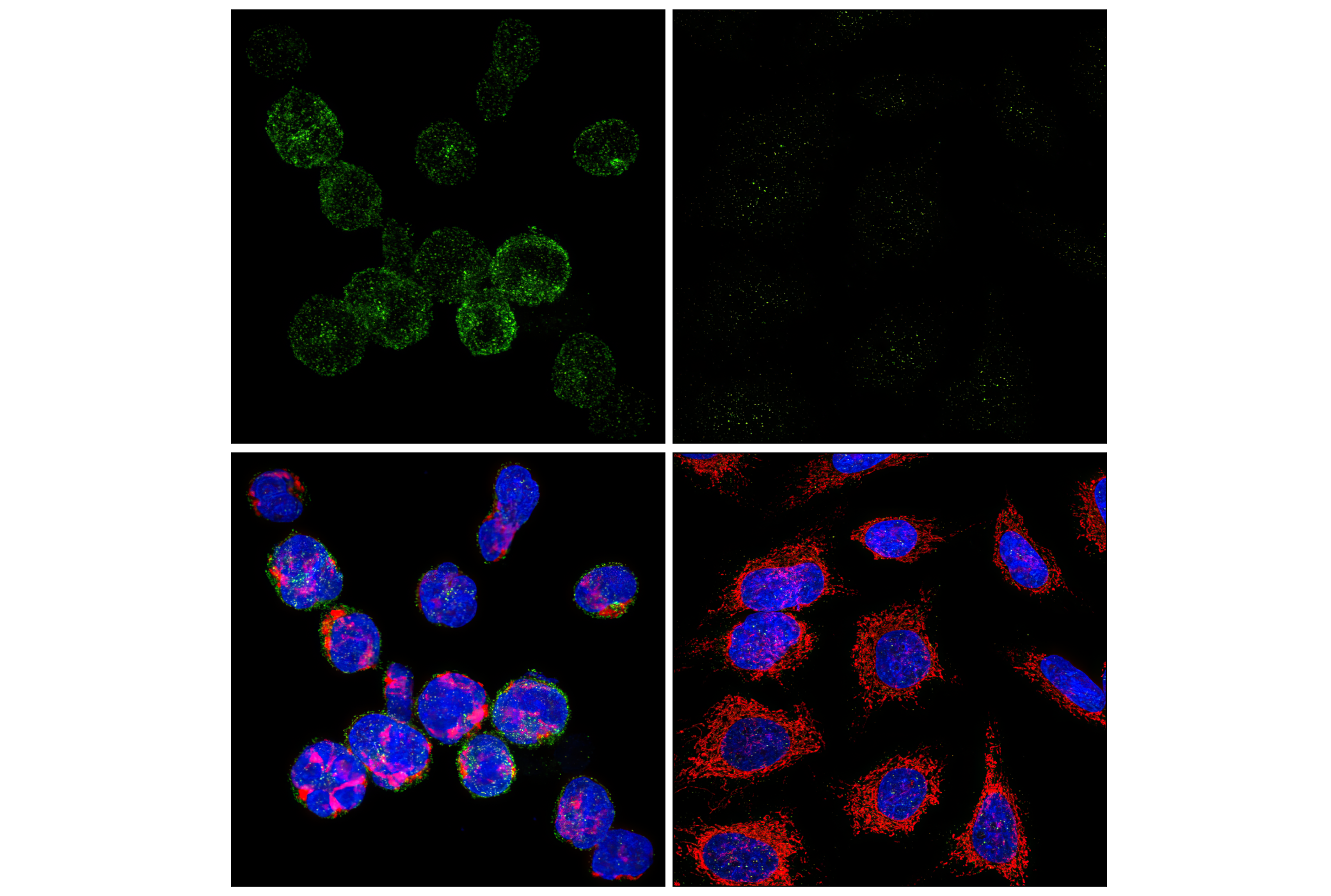 Immunofluorescence Image 1: PD-1 (Intracellular Domain) (D4W2J) XP® Rabbit mAb (BSA and Azide Free)