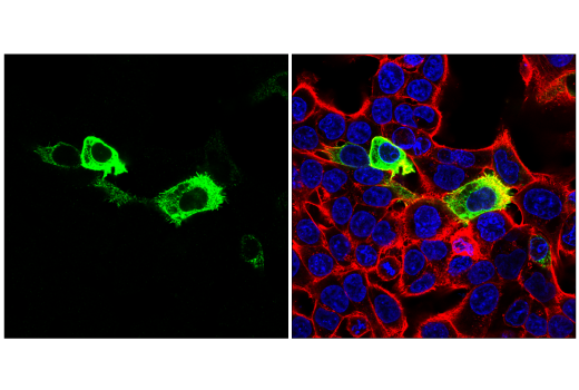 Immunofluorescence Image 1: SARS-CoV-2 Spike Protein (RBD) (E7B3E) Rabbit mAb