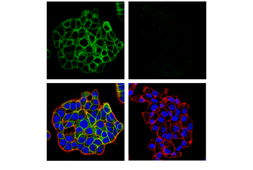 Immunofluorescence Image 1: RhoB (D1J9V) Rabbit mAb