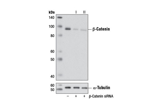  Image 1: SignalSilence® β-Catenin siRNA I (Mouse Specific)