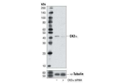  Image 1: SignalSilence® CK2α siRNA I