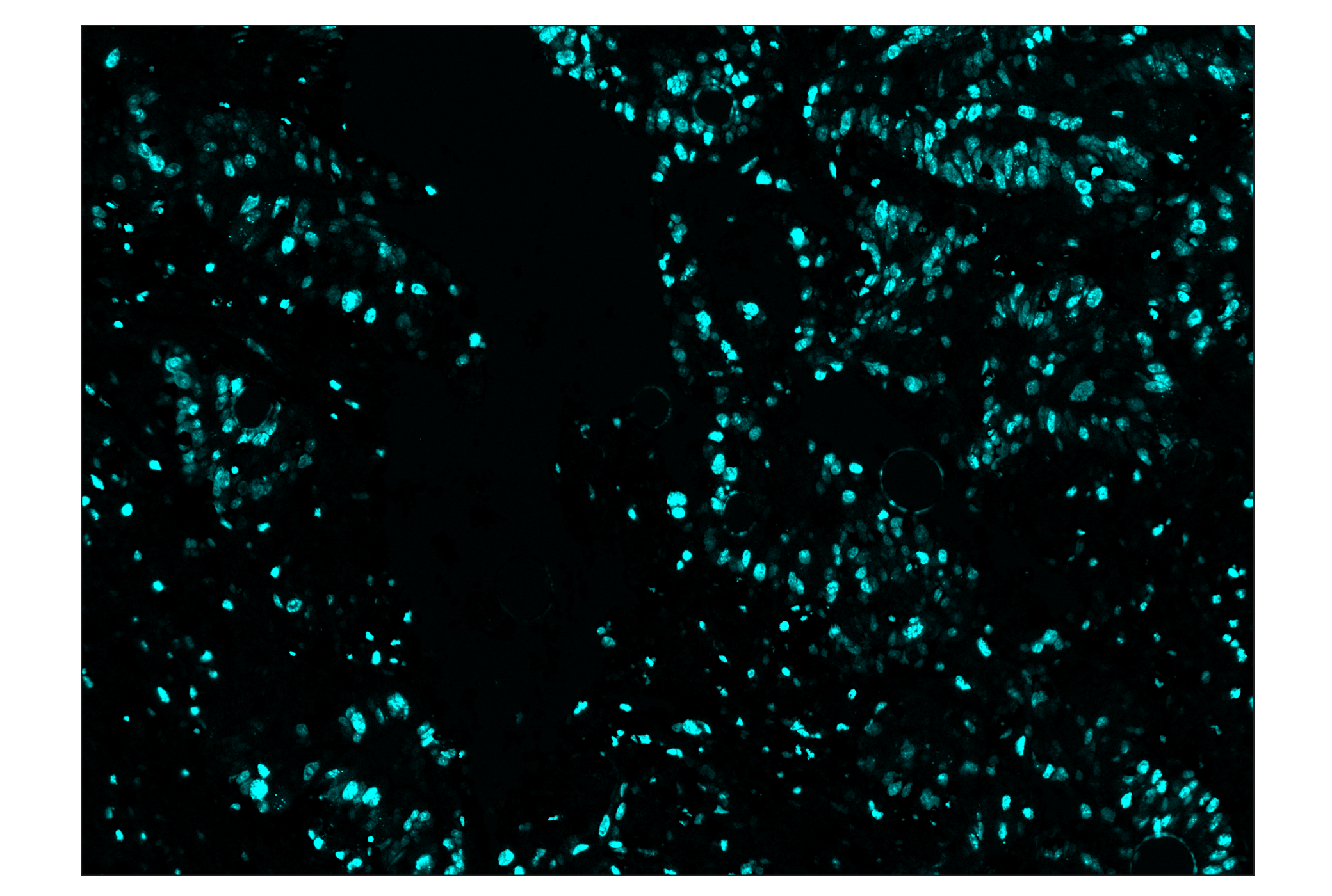 Immunohistochemistry Image 5: Ki-67 (8D5) & CO-0014-594 SignalStar™ Oligo-Antibody Pair