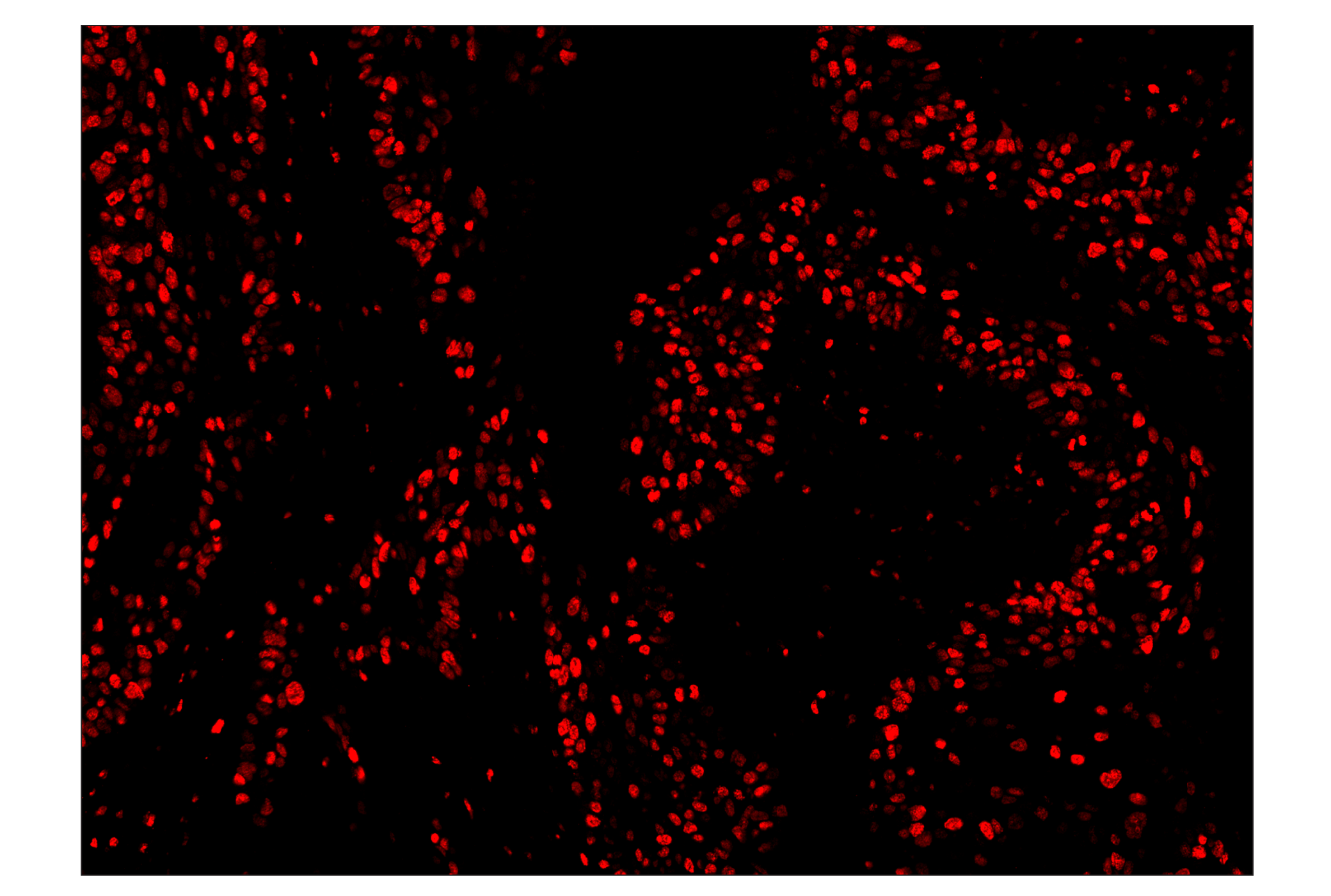 Immunohistochemistry Image 4: Ki-67 (8D5) & CO-0014-750 SignalStar™ Oligo-Antibody Pair