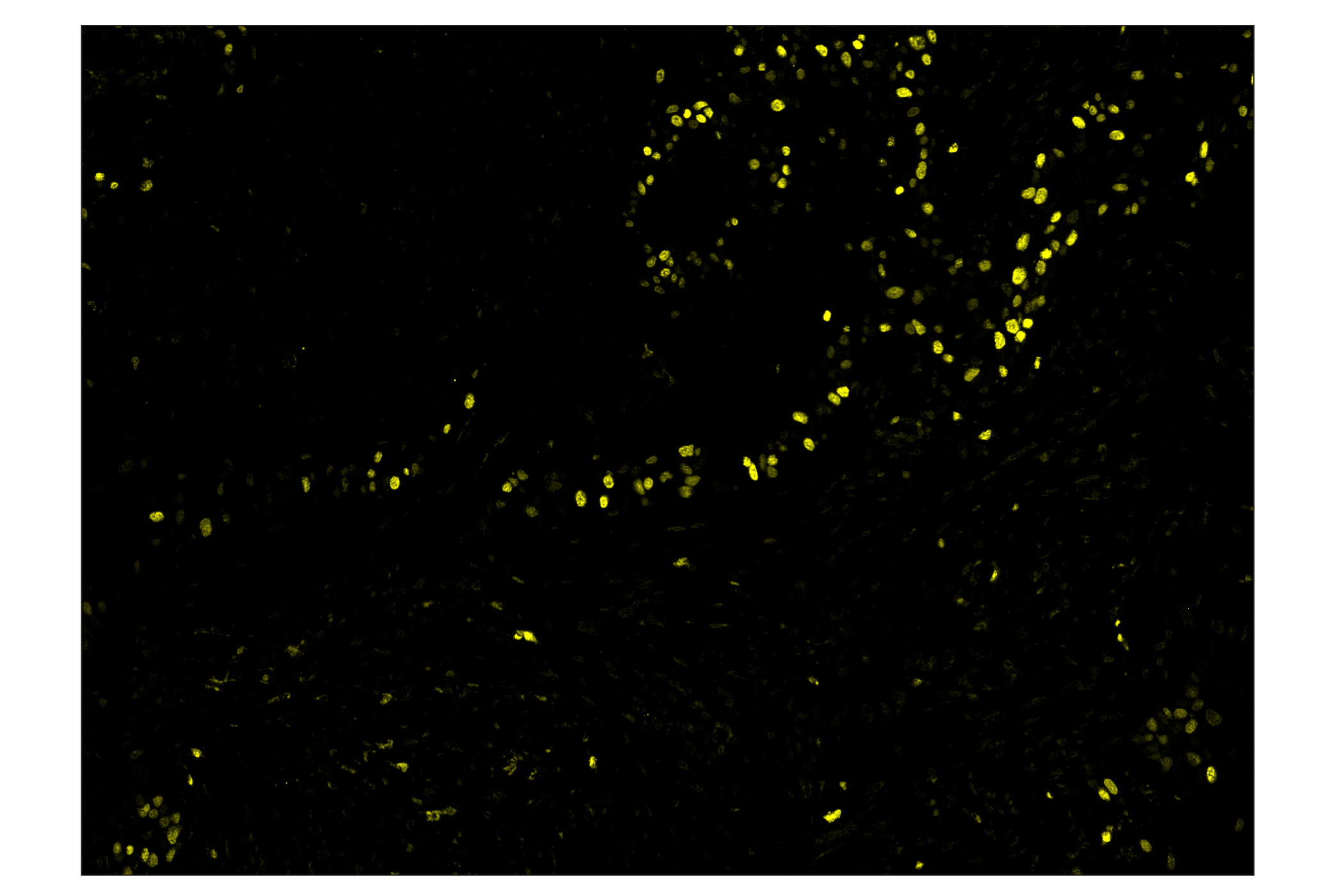Immunohistochemistry Image 3: Ki-67 (8D5) & CO-0014-750 SignalStar™ Oligo-Antibody Pair