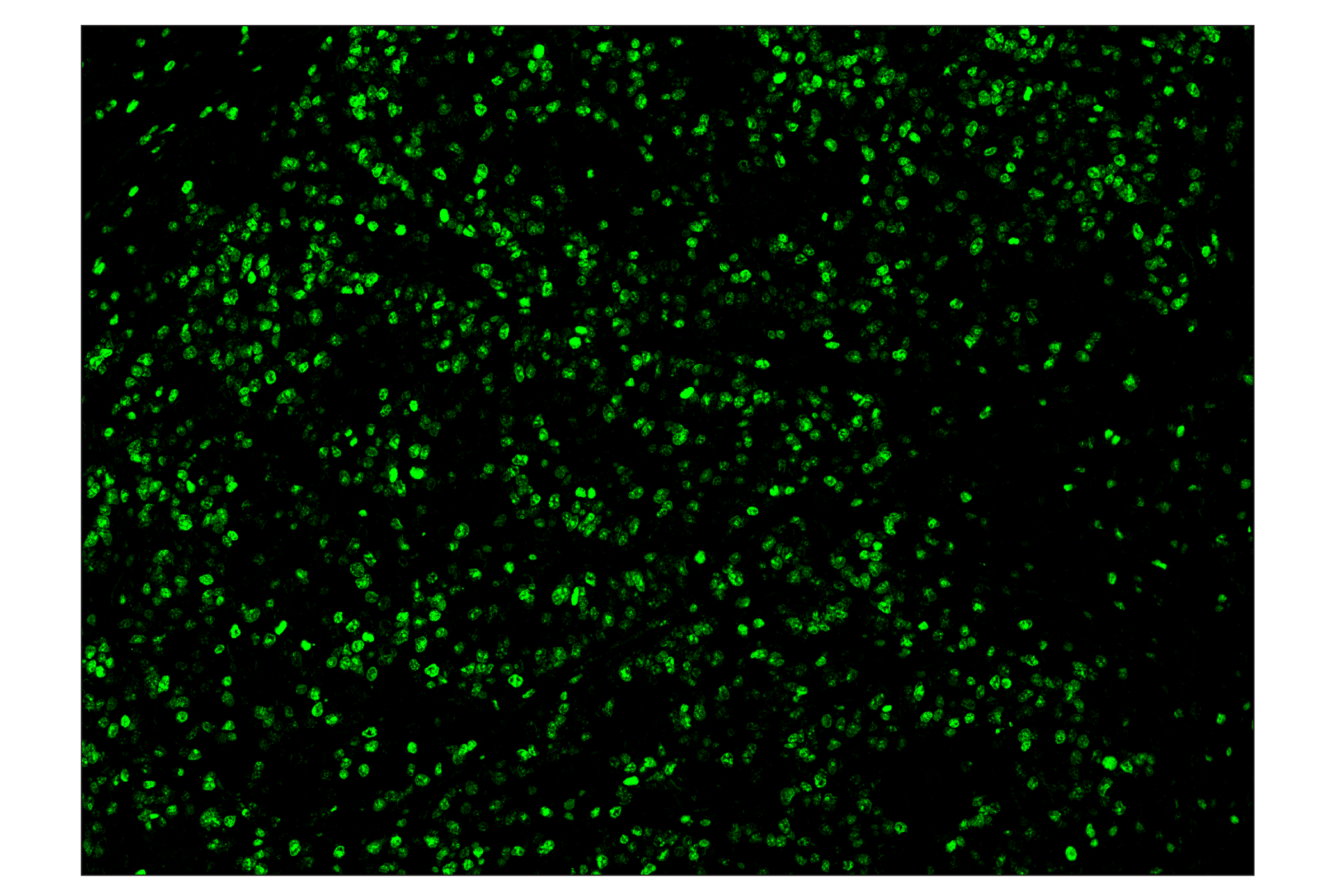 Immunohistochemistry Image 2: Ki-67 (8D5) & CO-0014-750 SignalStar™ Oligo-Antibody Pair