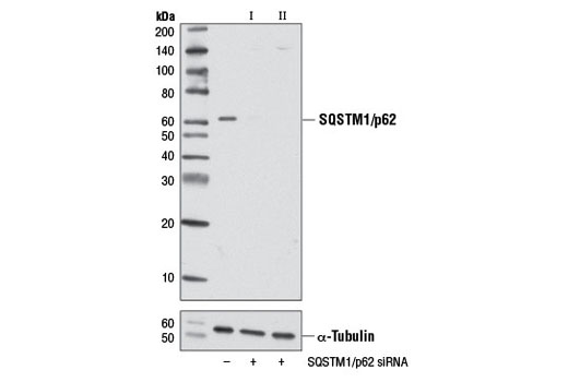 Image 1: SignalSilence® SQSTM1/p62 siRNA I
