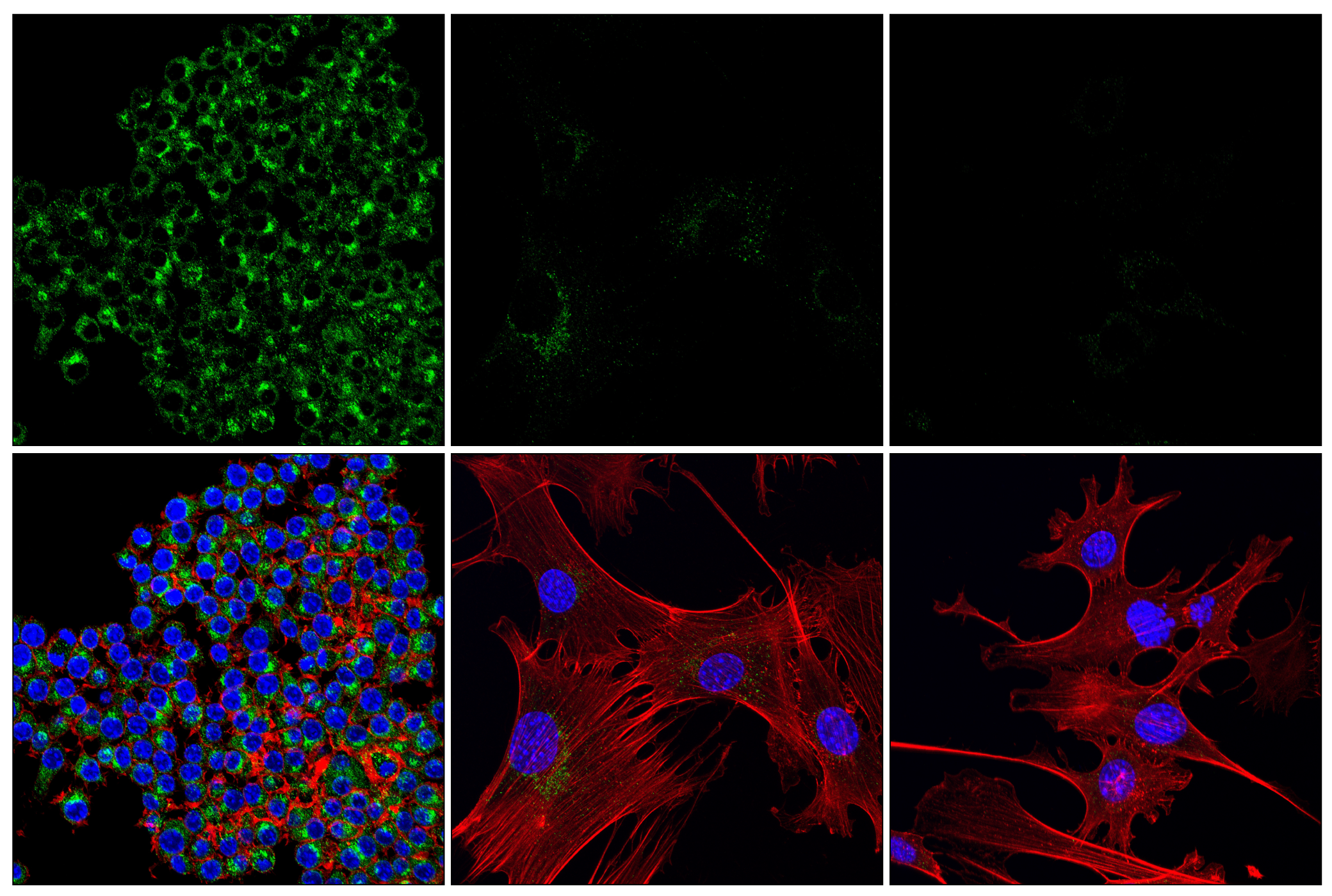 Immunofluorescence Image 2: β2-microglobulin (E8G2O) Rabbit mAb