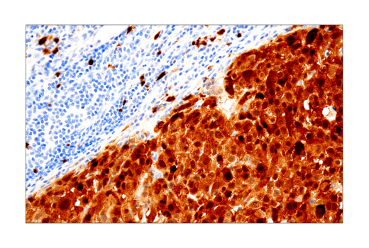 Immunohistochemistry Image 1: S100A1 (4C4.9) Mouse mAb
