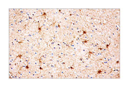 Immunohistochemistry Image 2: S100A1 (4C4.9) Mouse mAb