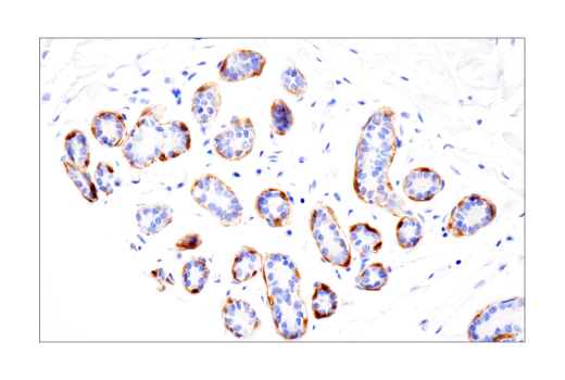 Immunohistochemistry Image 3: S100A1 (4C4.9) Mouse mAb