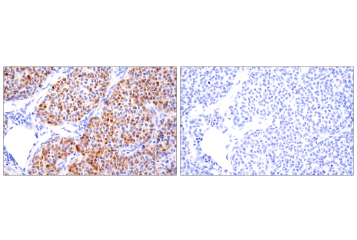 Immunohistochemistry Image 5: S100A1 (4C4.9) Mouse mAb