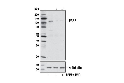  Image 1: SignalSilence® PARP siRNA I (Mouse Specific)