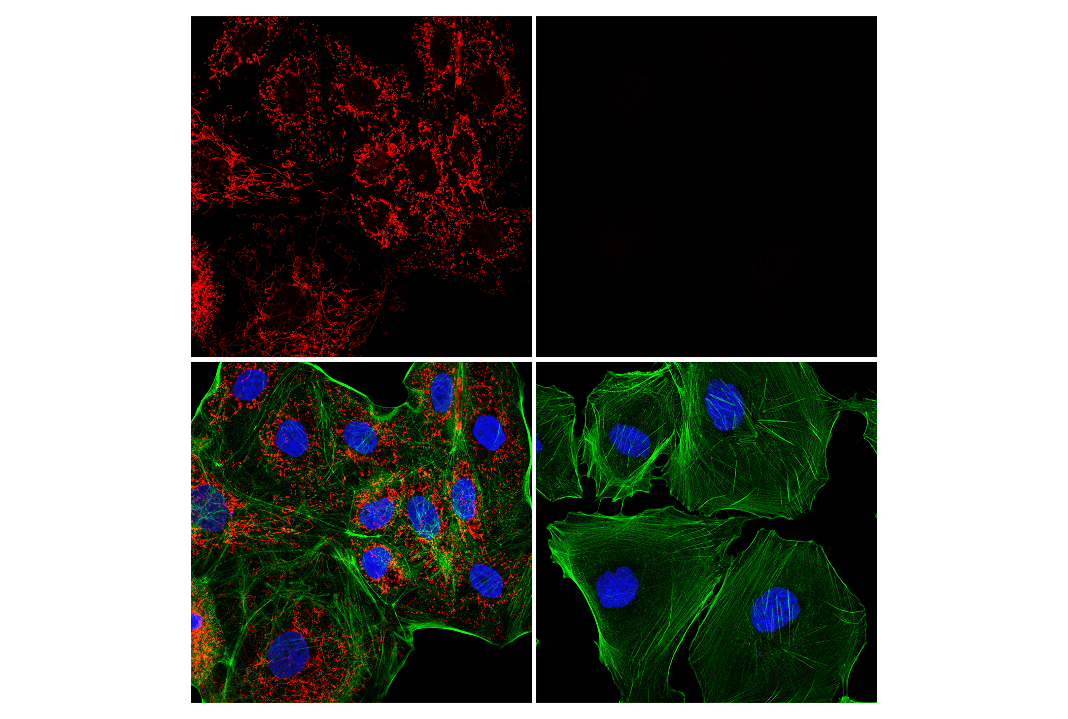 Immunofluorescence Image 1: MTHFD2 (E7A4L) XP® Rabbit mAb (Alexa Fluor® 647 Conjugate)