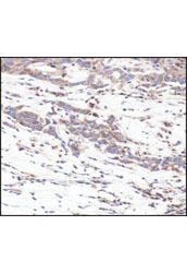 Immunohistochemistry Image 3: S6 Ribosomal Protein (54D2) Mouse mAb (BSA and Azide Free)