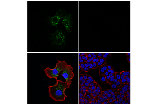Immunofluorescence Image 1: IGFBP3 (E6C2E) Rabbit mAb