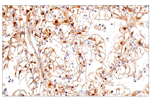 Immunohistochemistry Image 4: IGFBP3 (E6C2E) Rabbit mAb
