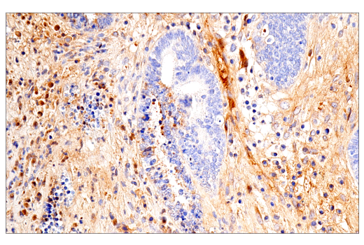 Immunohistochemistry Image 5: IGFBP3 (E6C2E) Rabbit mAb
