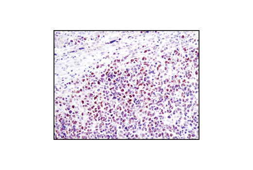 Immunohistochemistry Image 2: NUT (C52B1) Rabbit mAb (BSA and Azide Free)