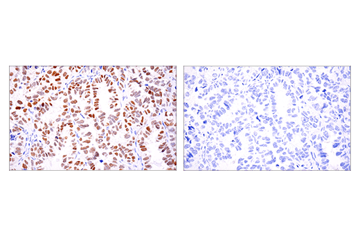 Immunohistochemistry Image 5: Phospho-Chk2 (Thr68) (E8Q1A) Rabbit mAb (BSA and Azide Free)