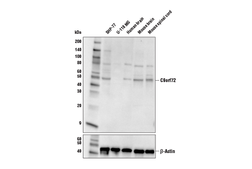Western Blotting Image 1: C9orf72 Antibody