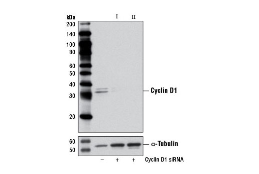  Image 1: SignalSilence® Cyclin D1 siRNA I (Mouse Specific)