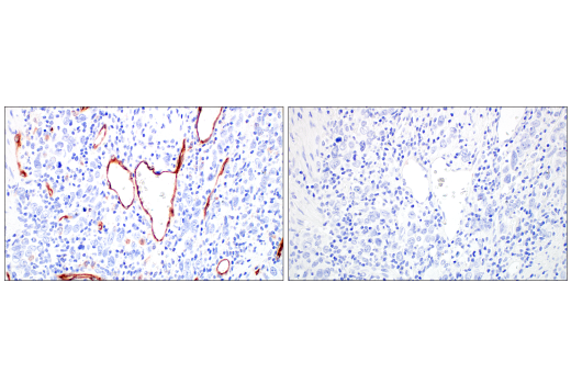 Immunohistochemistry Image 10: PLVAP (E3X9D) Rabbit mAb (BSA and Azide Free)