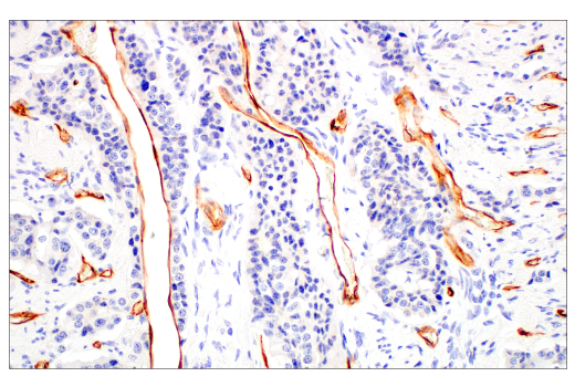 Immunohistochemistry Image 1: PLVAP (E3X9D) Rabbit mAb (BSA and Azide Free)