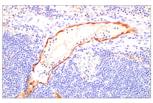 Immunohistochemistry Image 8: PLVAP (E3X9D) Rabbit mAb (BSA and Azide Free)