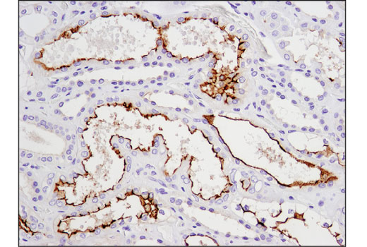Immunohistochemistry Image 4: CD133 (D2V8Q) XP® Rabbit mAb