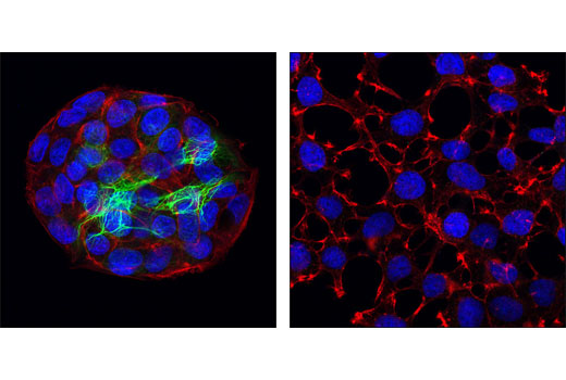 Immunofluorescence Image 1: Keratin 18 (DC10) Mouse mAb (BSA and Azide Free)