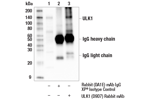 Immunoprecipitation Image 1: ULK1 (D9D7) Rabbit mAb