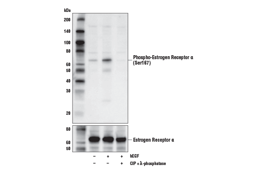 Western Blotting Image 1: Phospho-Estrogen Receptor α (Ser167) (D5W3Z) Rabbit mAb