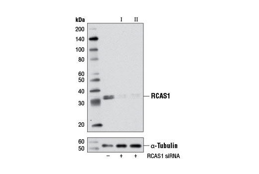  Image 1: SignalSilence® RCAS1 siRNA I