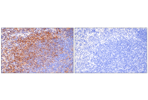 Immunohistochemistry Image 15: CD38 (E9F5A) XP® Rabbit mAb (BSA and Azide Free)