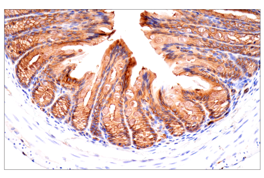 Immunohistochemistry Image 13: CD38 (E9F5A) XP® Rabbit mAb (BSA and Azide Free)