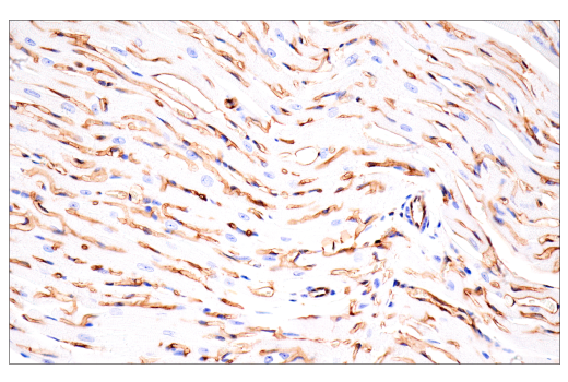 Immunohistochemistry Image 12: CD38 (E9F5A) XP® Rabbit mAb (BSA and Azide Free)