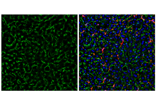 Immunofluorescence Image 2: CD38 (E9F5A) XP® Rabbit mAb (BSA and Azide Free)