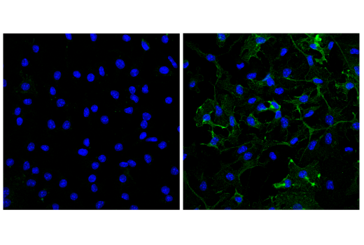 Immunofluorescence Image 3: CD38 (E9F5A) XP® Rabbit mAb (BSA and Azide Free)
