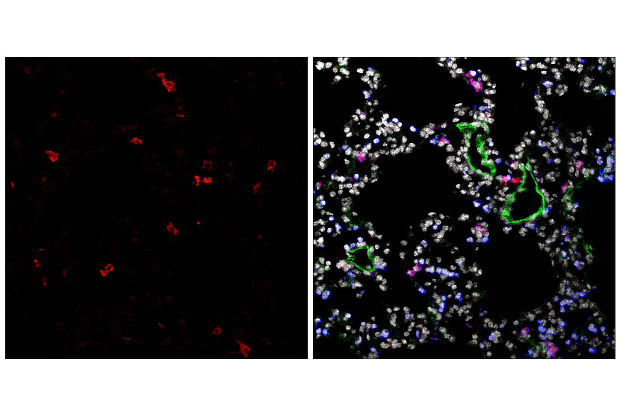 Immunofluorescence Image 3: CD11c (D1V9Y) Rabbit mAb (Alexa Fluor® 555 Conjugate)