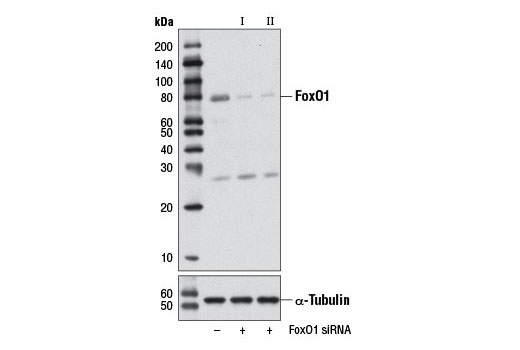  Image 1: SignalSilence® FoxO1 siRNA I (Mouse Specific)