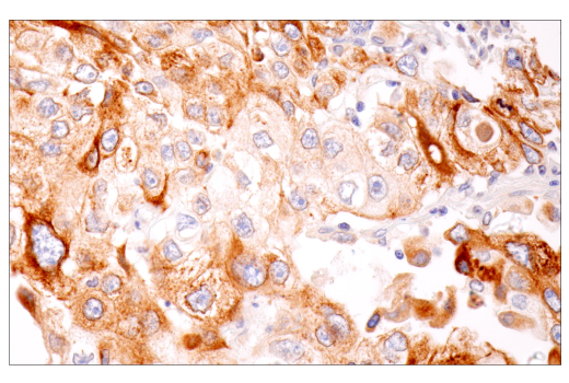 Immunohistochemistry Image 1: Furin (E2Y2F) Rabbit mAb