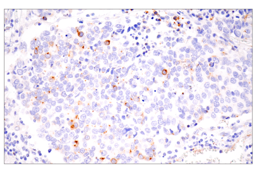 Immunohistochemistry Image 5: Furin (E2Y2F) Rabbit mAb