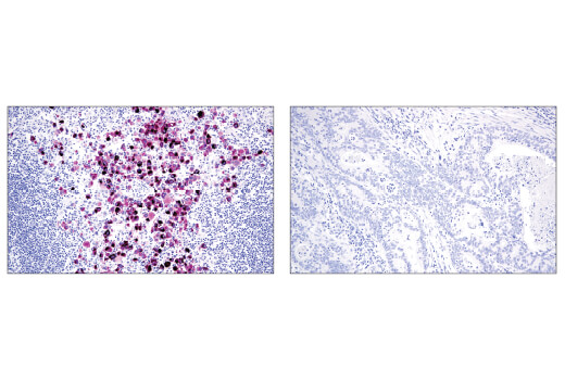 Immunohistochemistry Image 1: MLANA/MART-1 (E9Q4O) XP® Rabbit mAb (BSA and Azide Free)