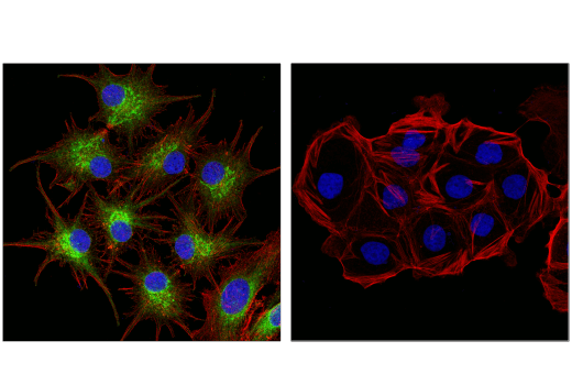 Immunofluorescence Image 1: MLANA/MART-1 (E9Q4O) XP® Rabbit mAb (BSA and Azide Free)